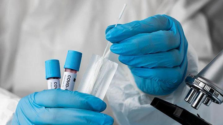 За минувшие сутки в Мурманской области выявили 26 случаев COVID-19